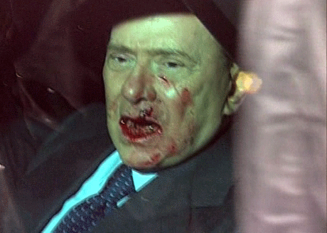 El primer ministro Silvio Berlusconi en un veh&iacute;culo despu&eacute;s de que le arrojaran un objeto en la cara en una imagen de video proporcionada por RAI TG3 en Mil&aacute;n.