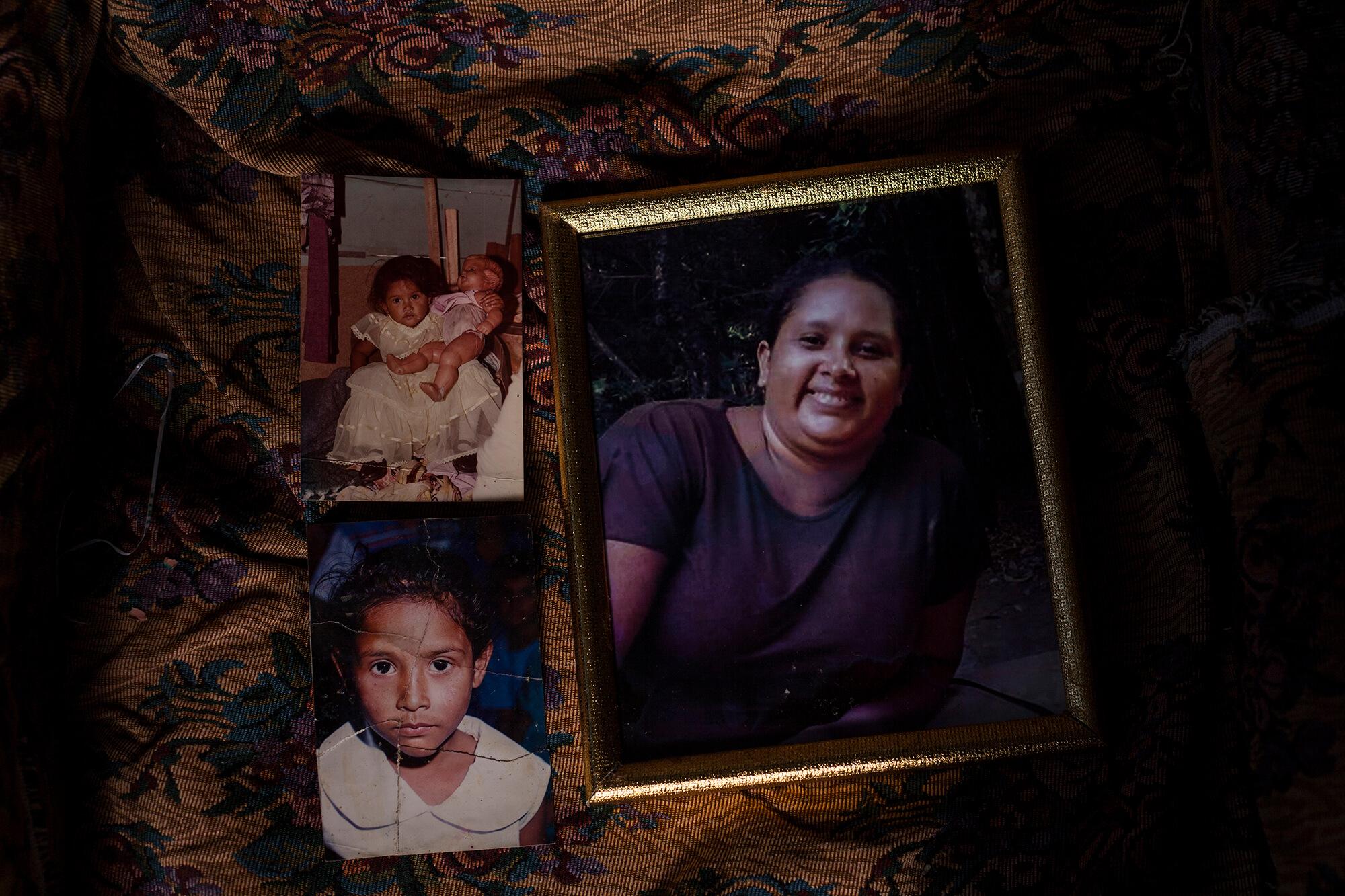 Los médicos apostaron por salvar la vida de Claudia y la de su hijo, pese a ser un embarazo de alto riesgo para la vida de la madre.